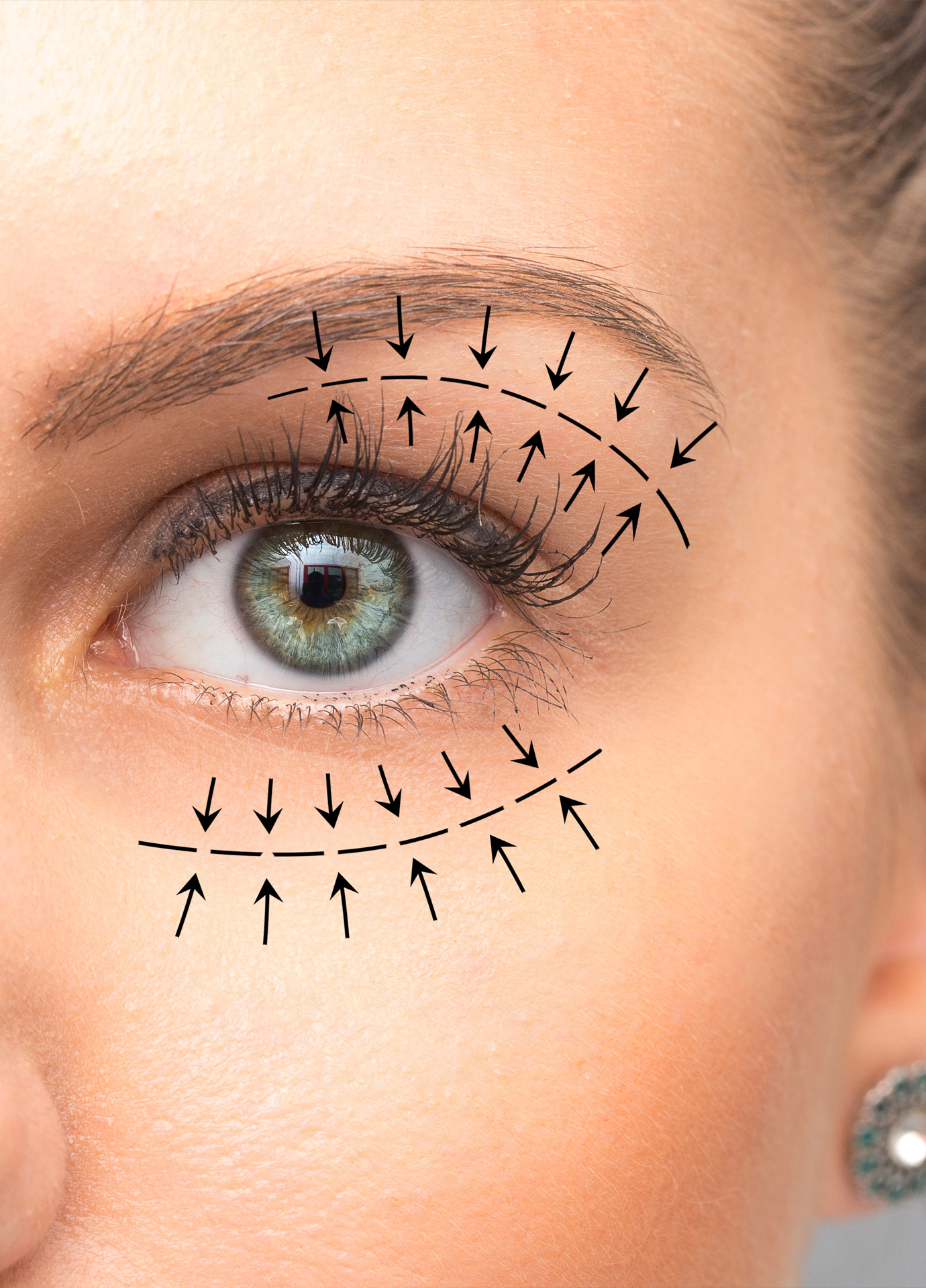 https://nooralmamzar.com/wp-content/uploads/2025/09/blepharoplasty.jpg