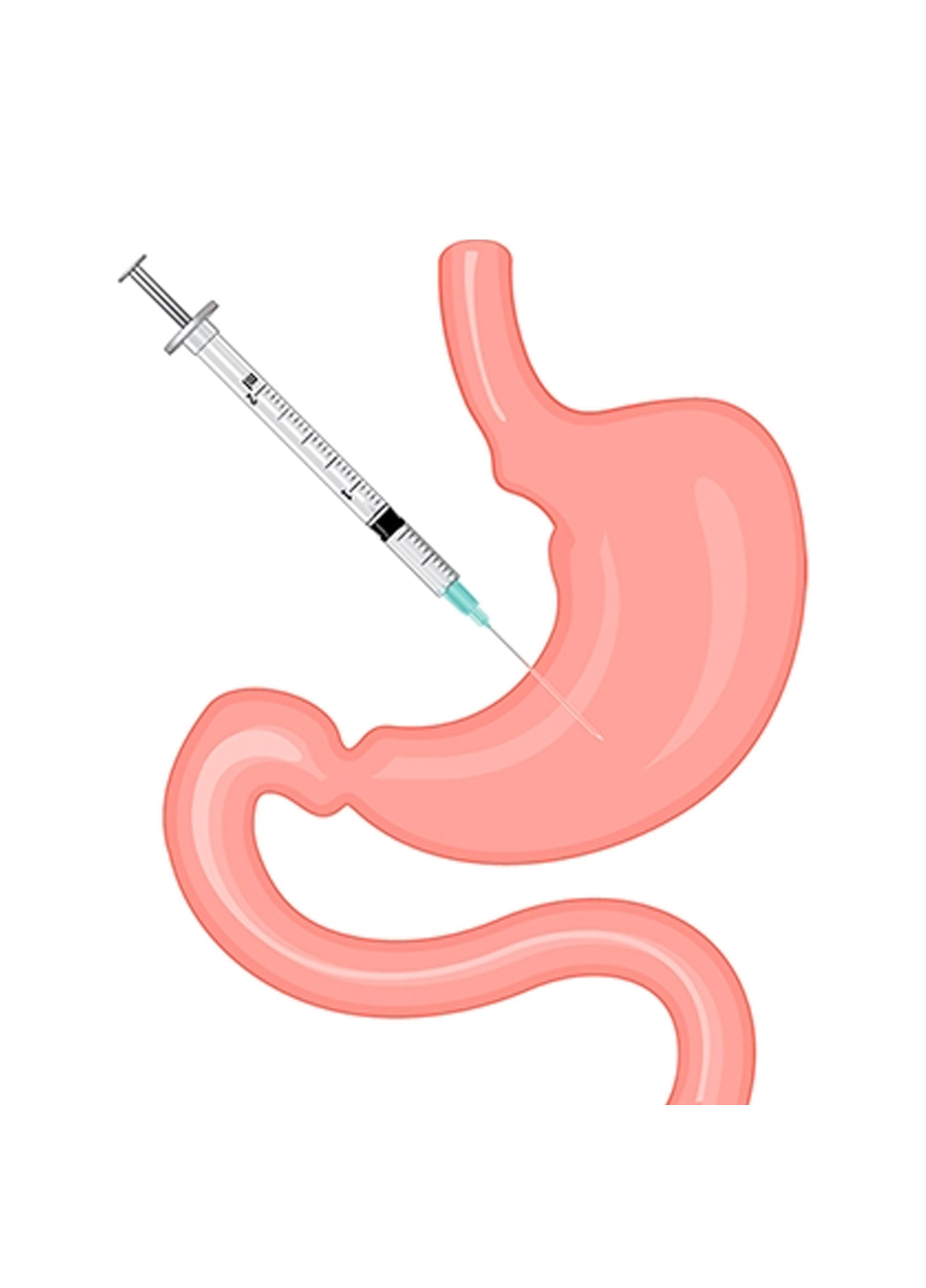 https://nooralmamzar.com/wp-content/uploads/2025/09/gastricbotox.jpg