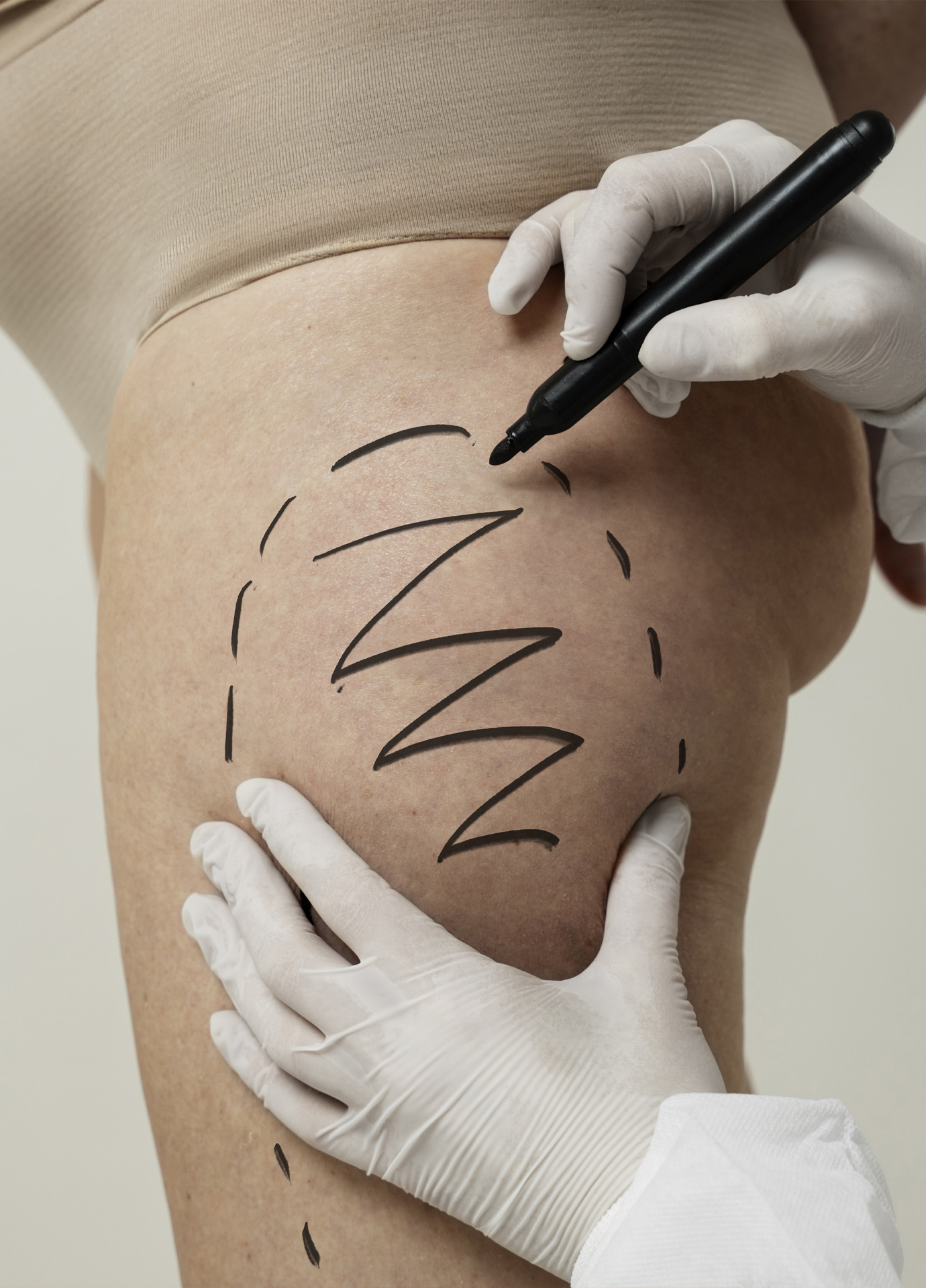 https://nooralmamzar.com/wp-content/uploads/2025/09/liposuction.jpg