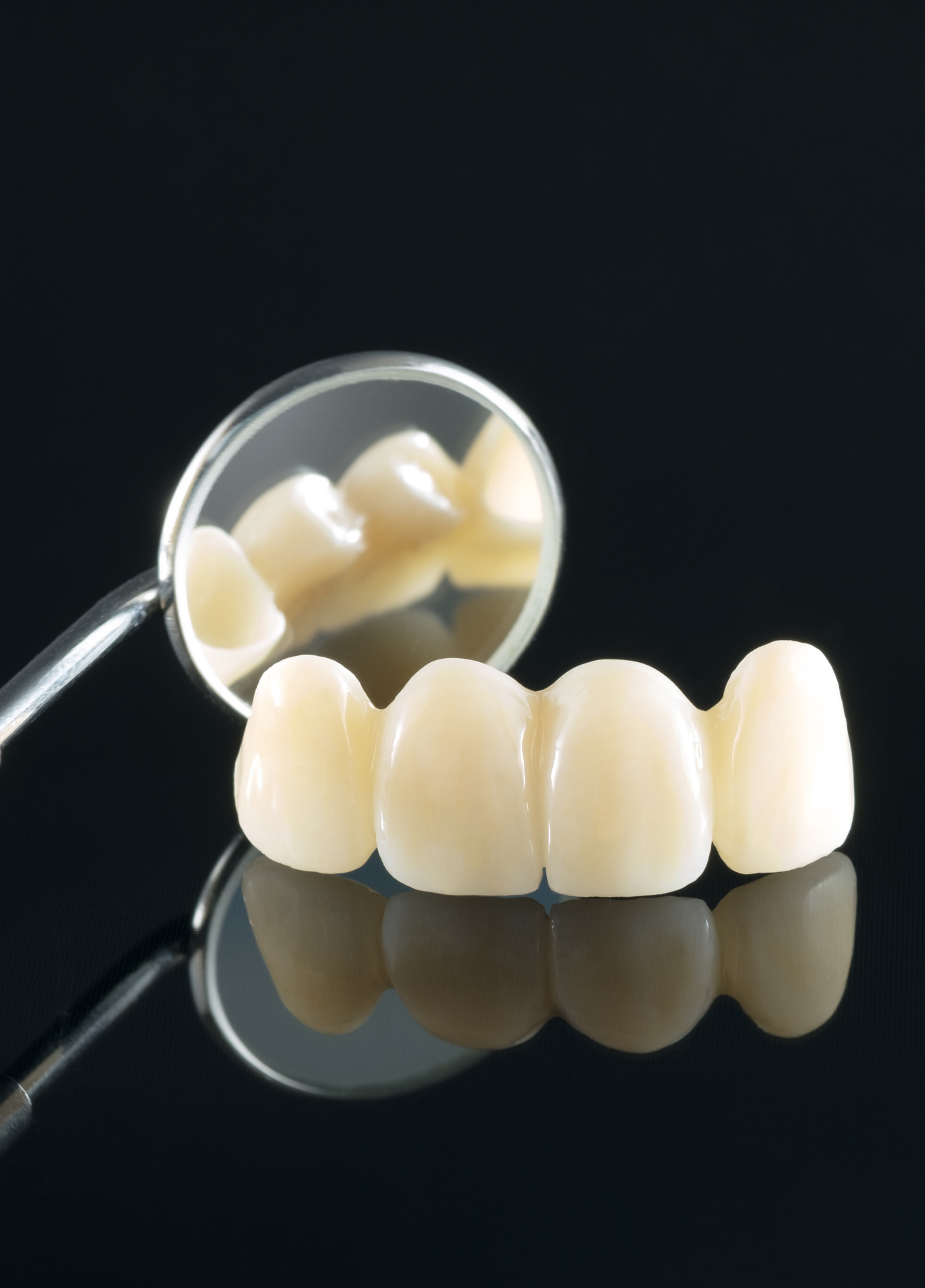 https://nooralmamzar.com/wp-content/uploads/2025/10/dental-bridge.jpg