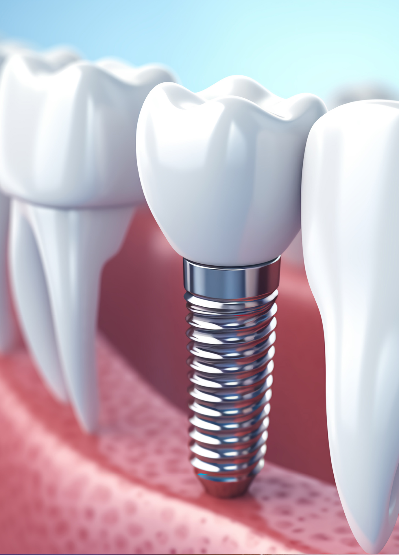 https://nooralmamzar.com/wp-content/uploads/2025/10/dental-implants.jpg