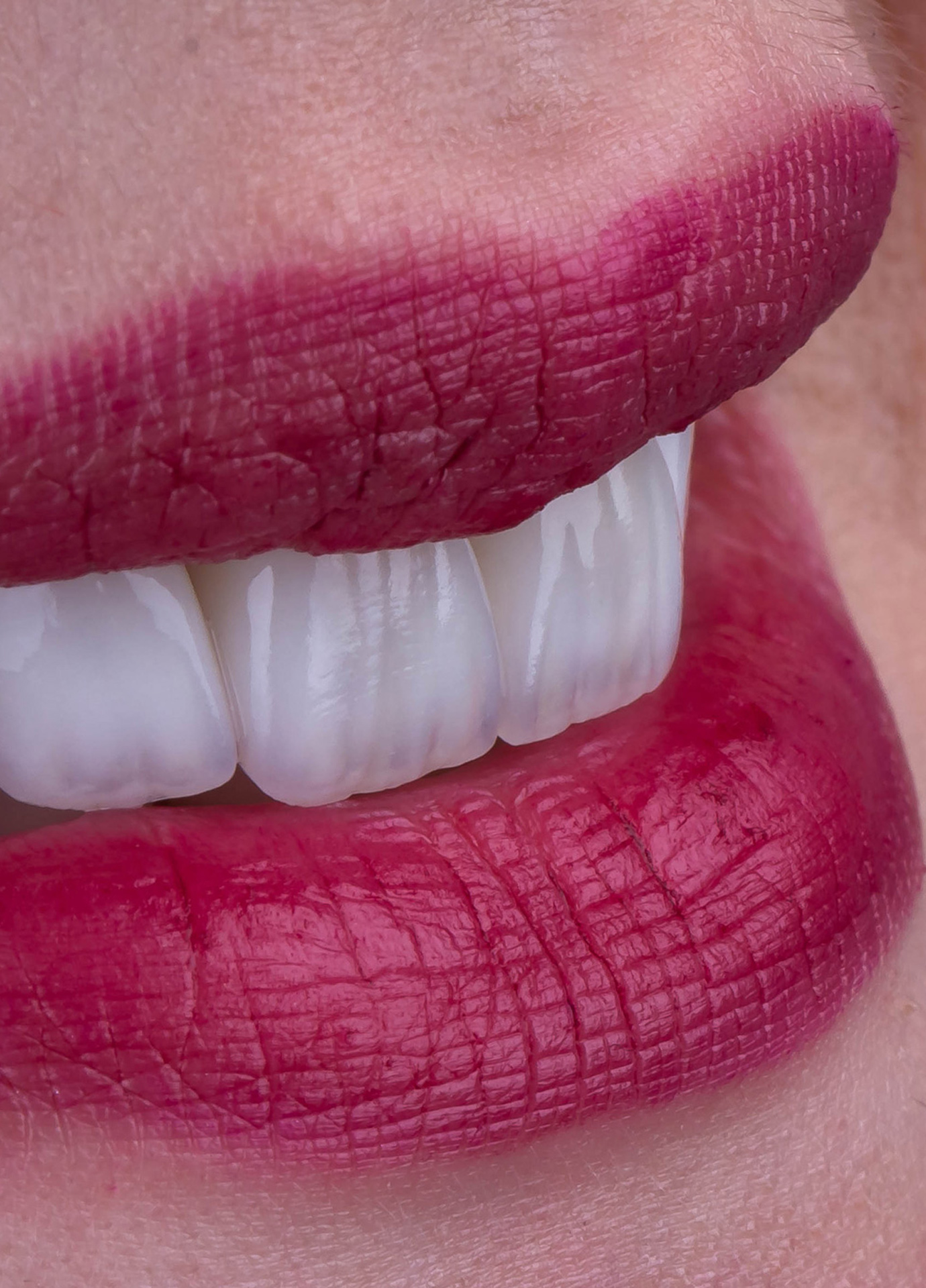 https://nooralmamzar.com/wp-content/uploads/2025/10/dental-veneers.jpg