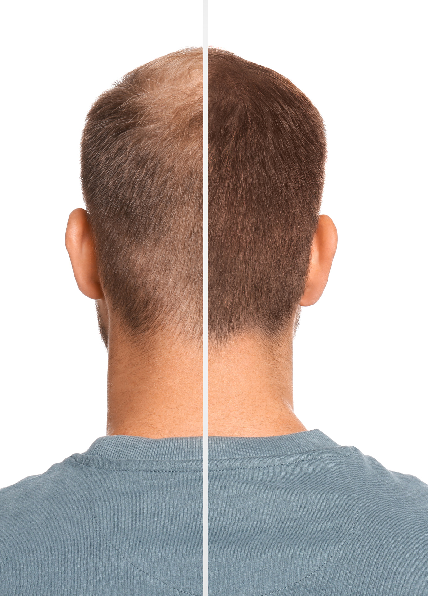 https://nooralmamzar.com/wp-content/uploads/2025/10/exosome-hair-therapy.jpg