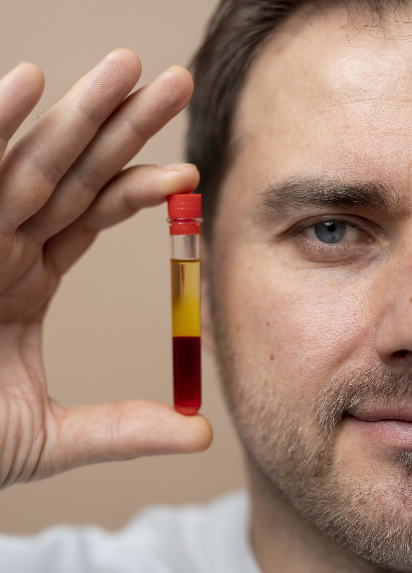 https://nooralmamzar.com/wp-content/uploads/2025/10/red-plasma.jpg