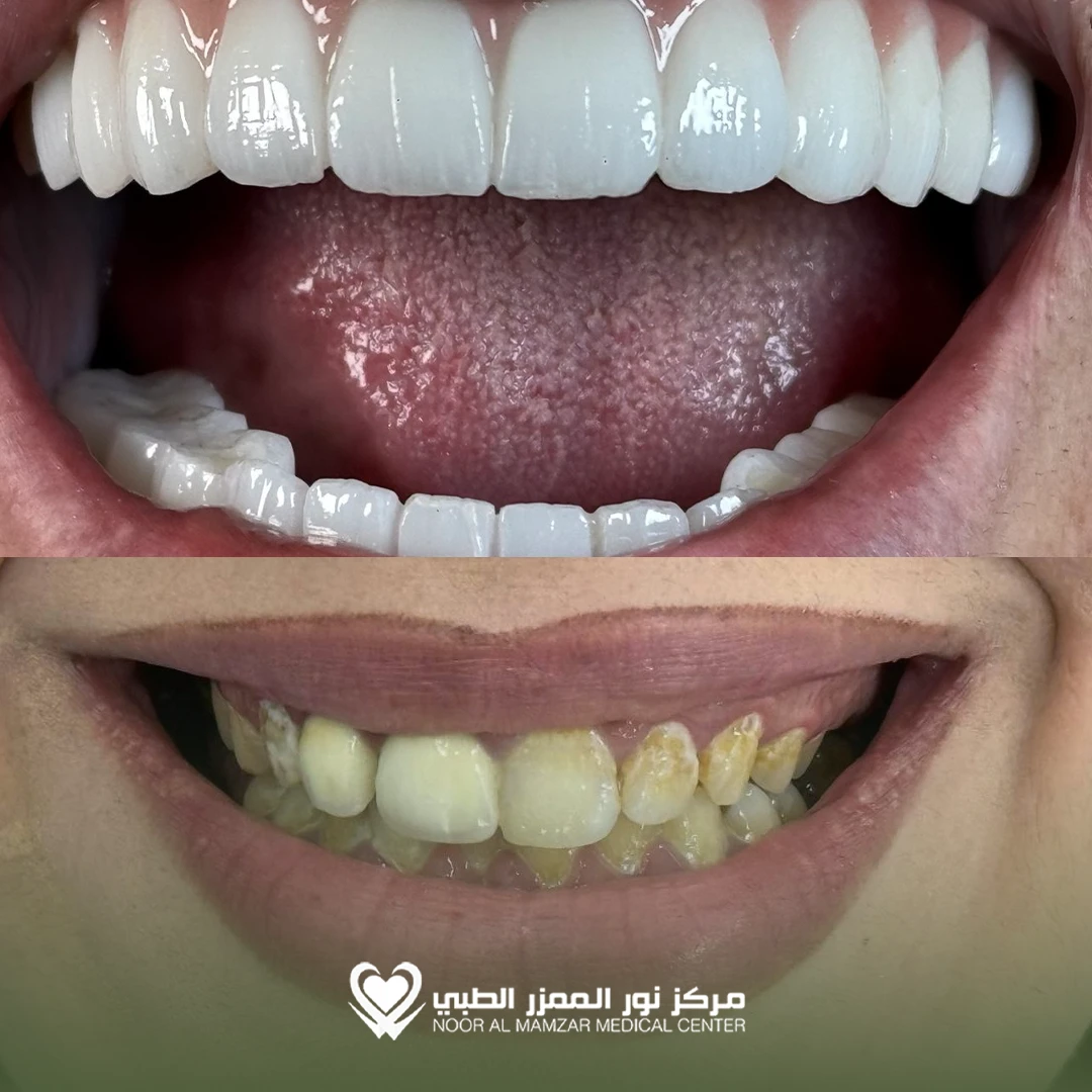 Dental before and After 1