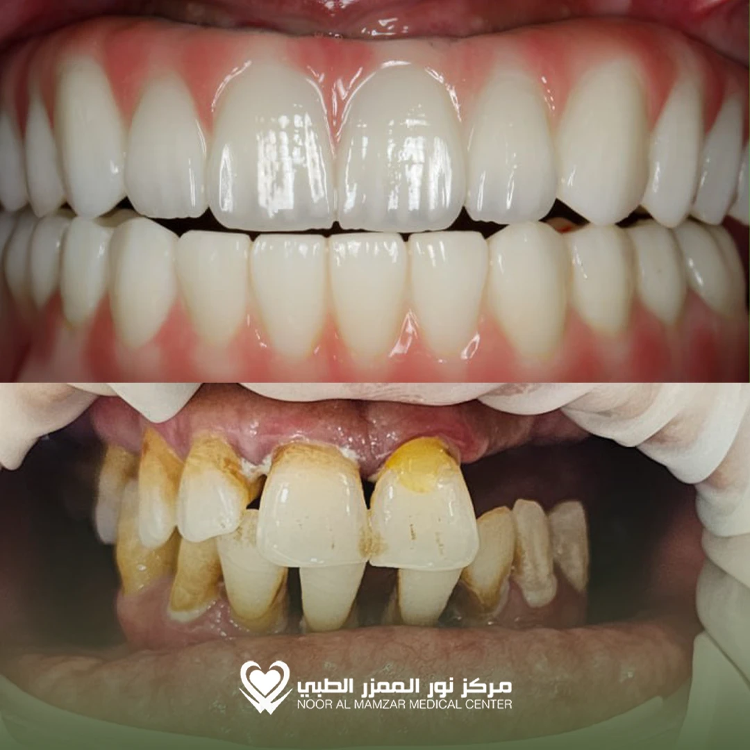 Dental before and After 2