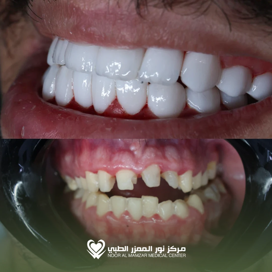 Dental before and After 7