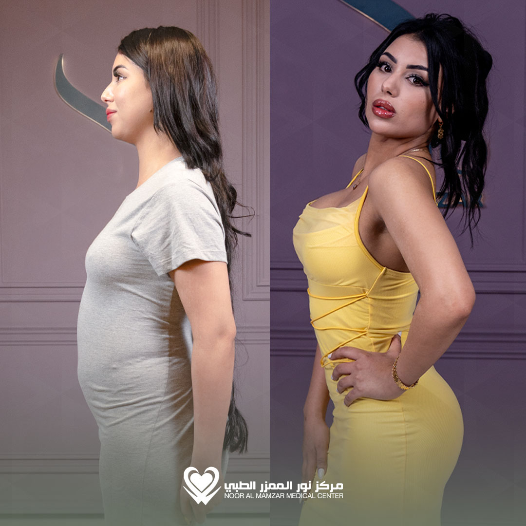 NMMC Before and After 2