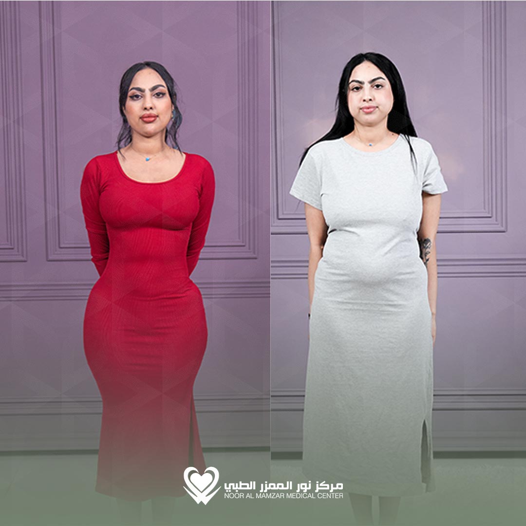 NMMC Before and After 4