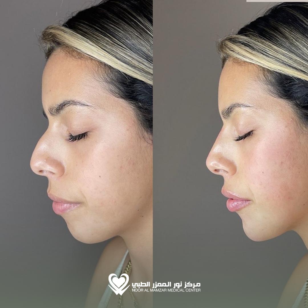 NMMC Before and After 5