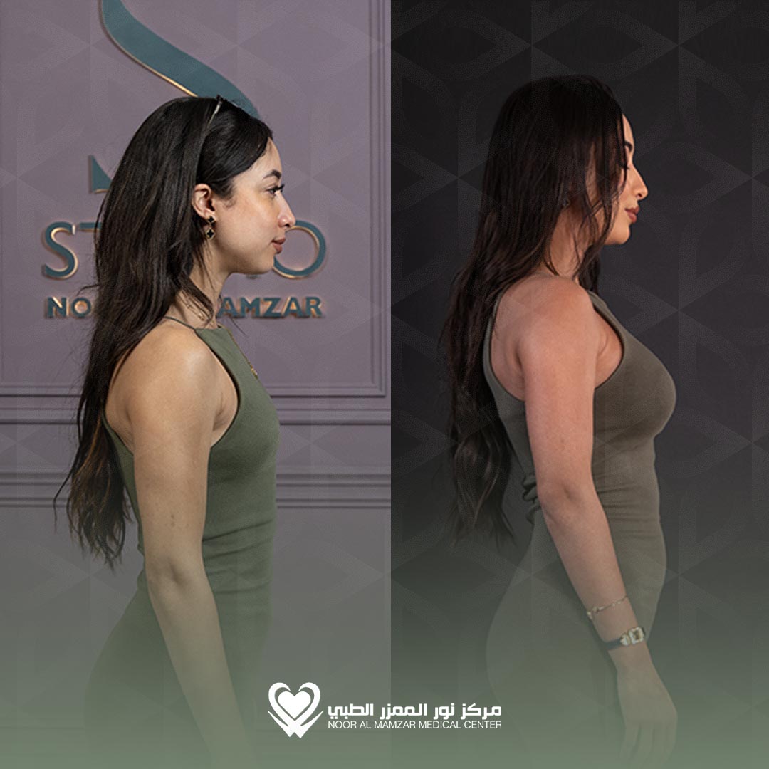 NMMC Before and After 6