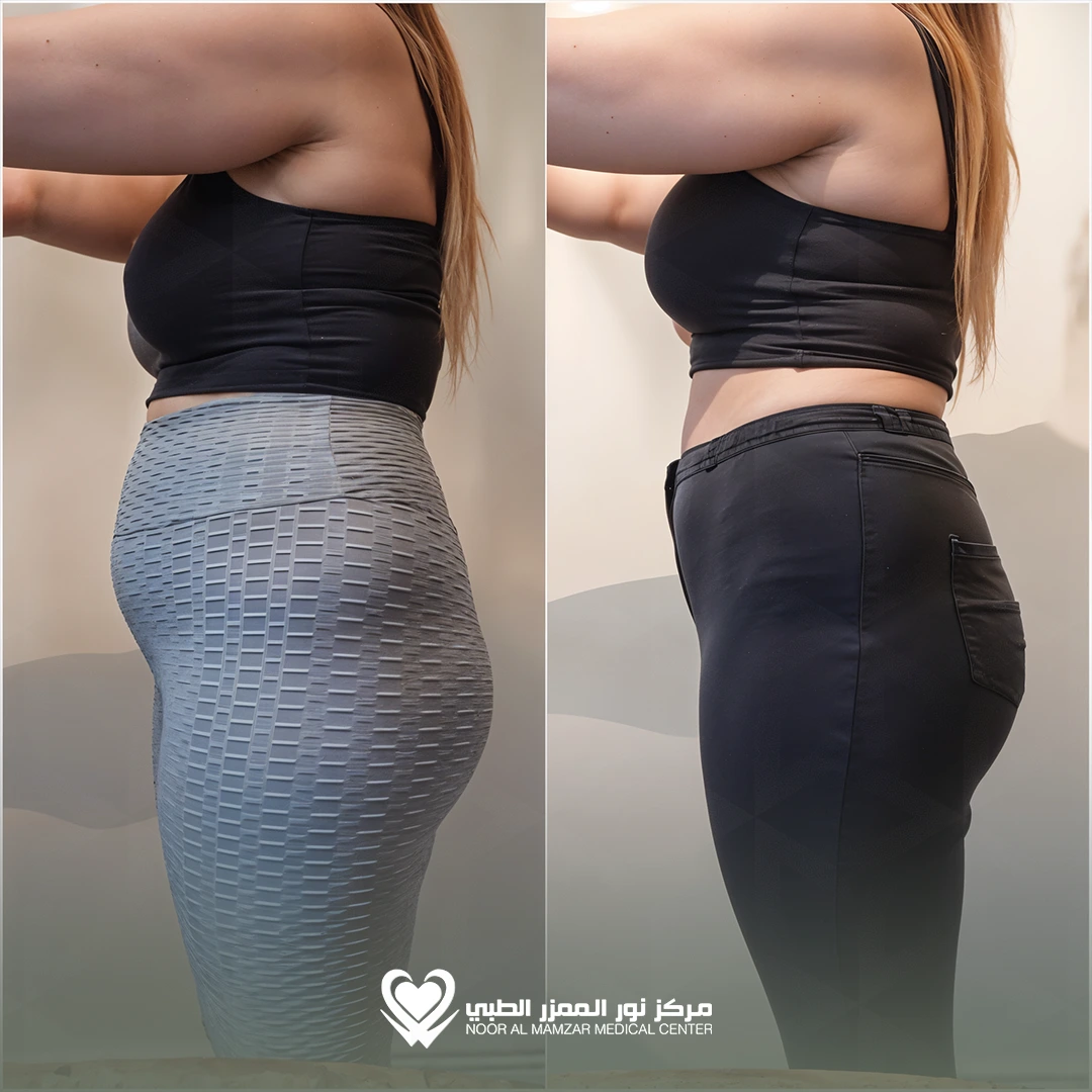 Weight Loss Solution 1