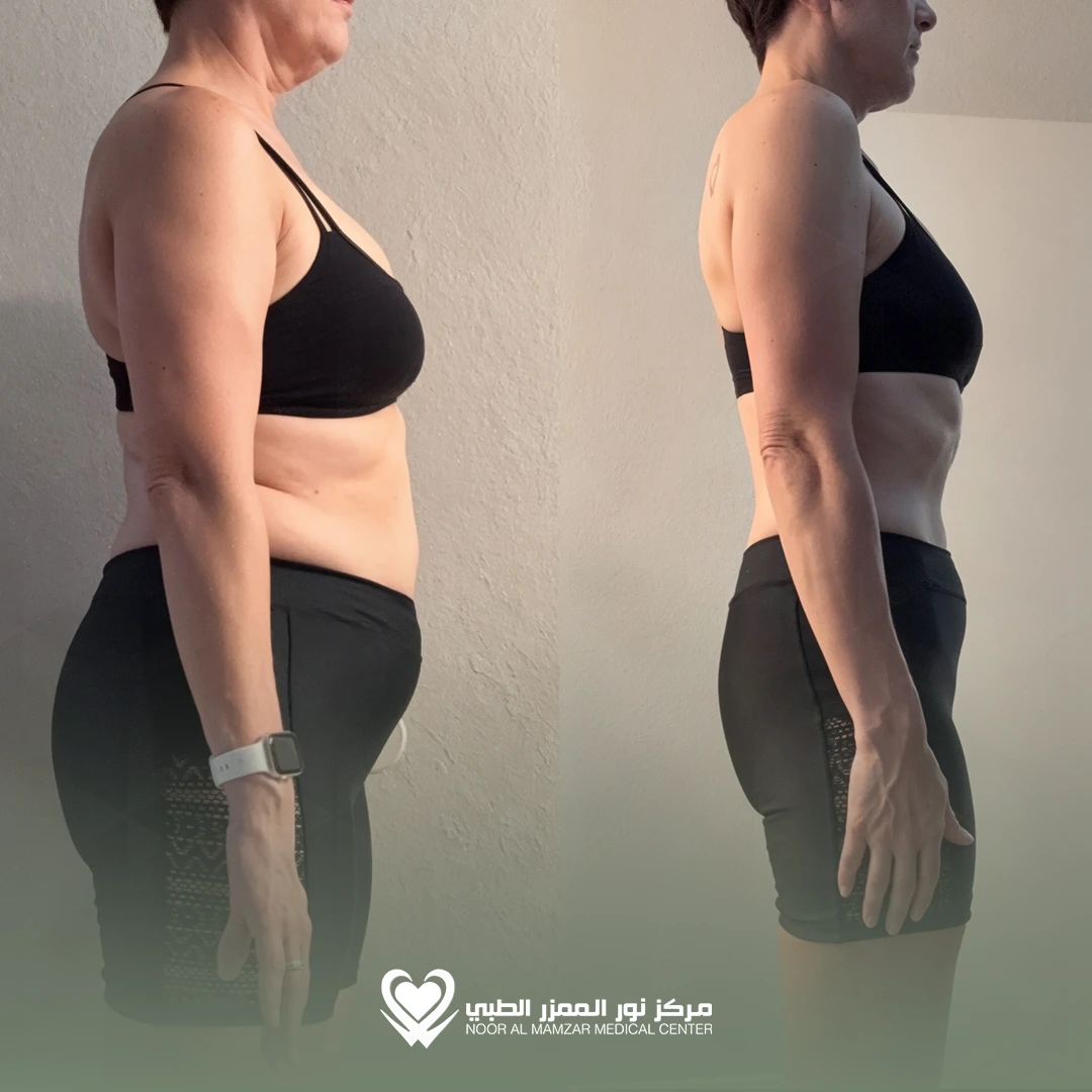 Weight Loss Solution 2