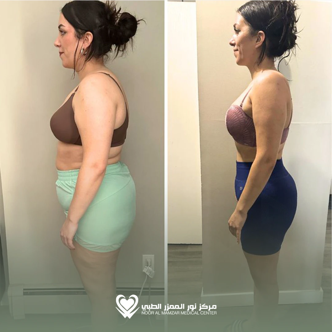 Weight Loss Solution 4