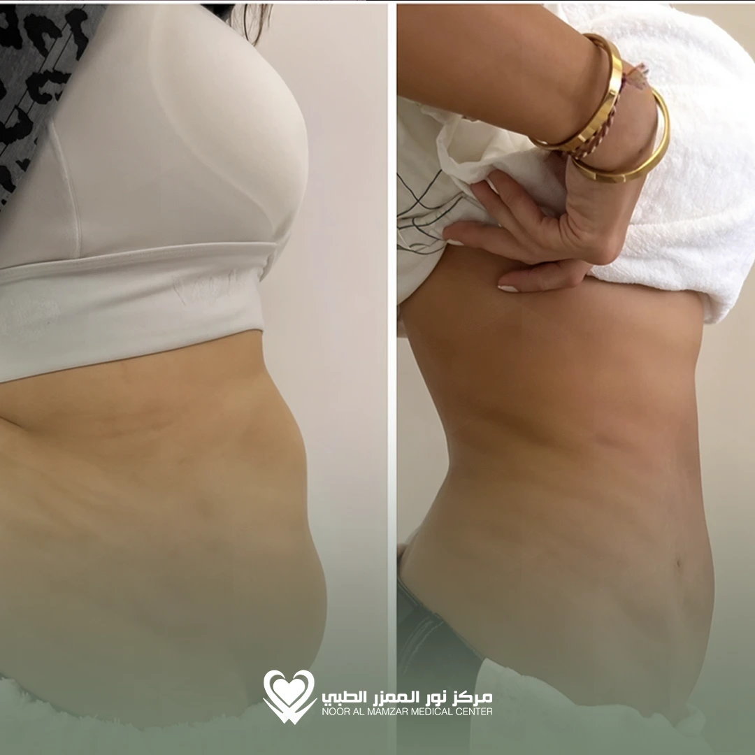 Weight Loss Solution 5