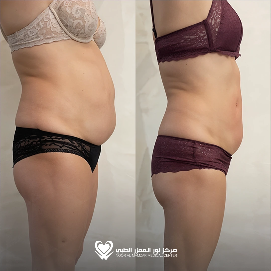 Weight Loss Solution 6