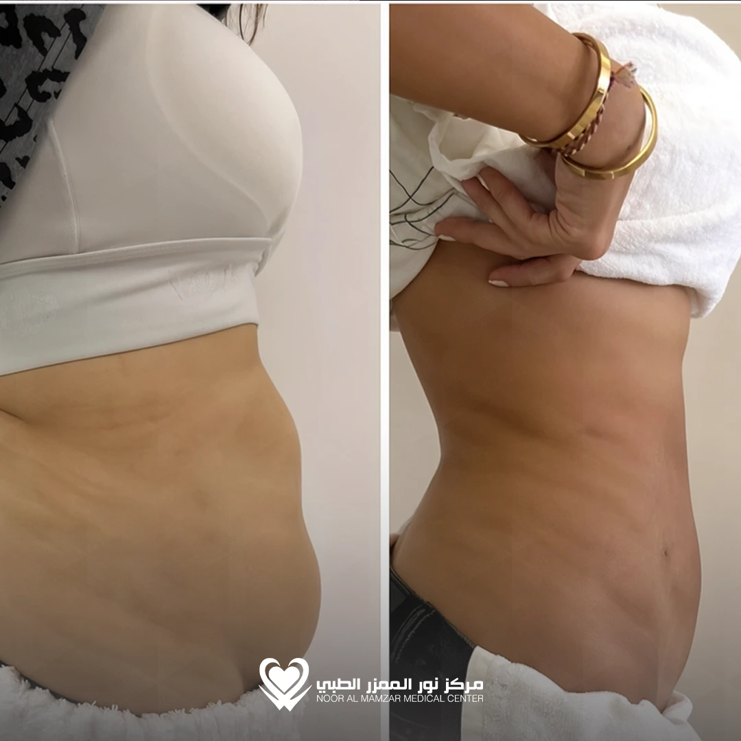 Weight Loss Solution 7