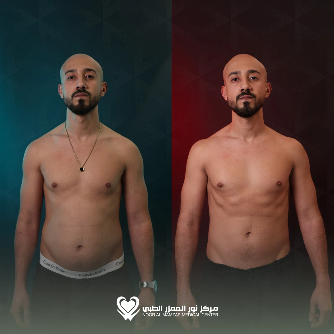 Weight Loss Solution