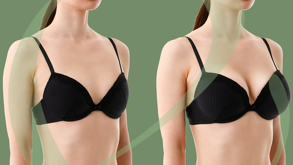 breast Injection Fillers Before and After Results