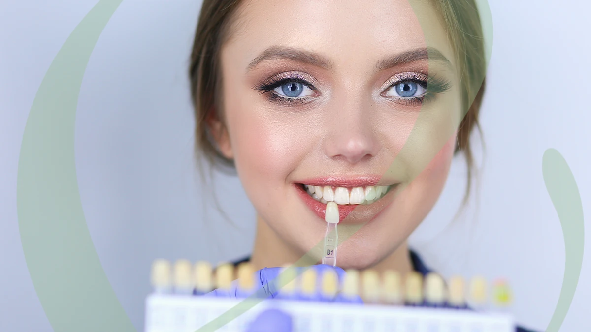 veneer teeth price in Dubai2